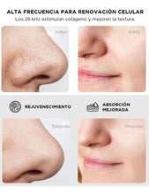 Cargar imagen en el visor de la galería, Espátula Facial Ultrasónica Gadnic · Limpieza Profunda y Lifting 🛒